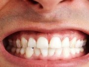 علت دندان قروچه کردن چیست؟!