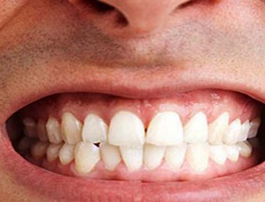 علت دندان قروچه کردن چیست؟!