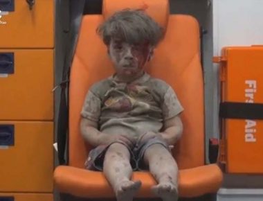 عمران، کودک پنج ساله‌ سوری نمادی از چهره زخمی حلب