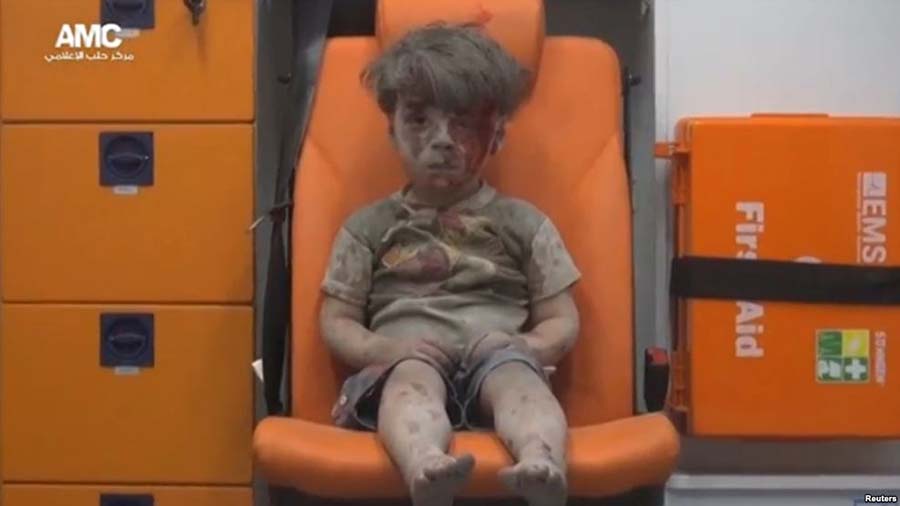 عمران، کودک پنج ساله‌ سوری نمادی از چهره زخمی حلب